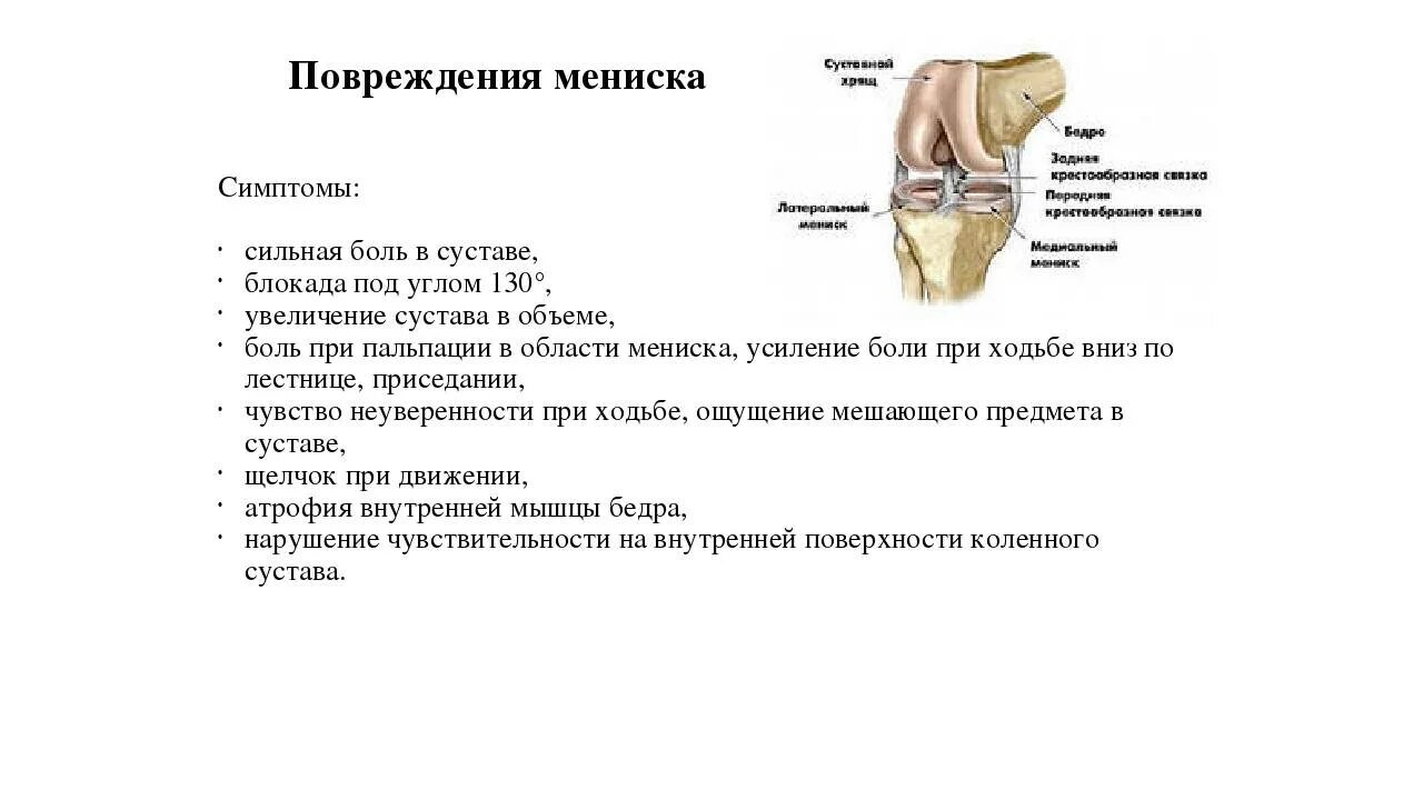 Внешние симптомы повреждения мениска коленного сустава. Для повреждения мениска коленного сустава характерен симптом кача. Повреждение менисков коленного сустава клинические признаки. Для повреждения мениска коленного сустава характерен симптом.