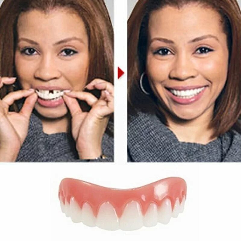 И новые варианты можно на. Perfect smile Veneers накладные виниры. Накладки для зубов съемные. Накладные зубы голливудская улыбка.