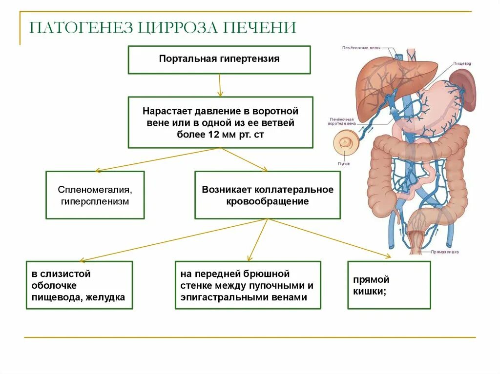 Гипертонии печень. Портальный цирроз печени патогенез. Механизм развития портальной гипертензии. Портальная гипертензия патанатомия. Патогенез цирроза печени портальная гипертензия.