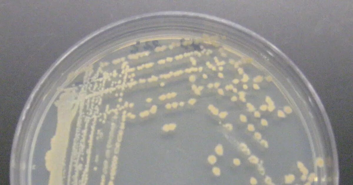 Bacillus subtilis что это. Bacillus mucilaginosus. биотестирование на bacillus subtilis. bacillus subtilis ч-13. антагонизм bacillus subtilis.