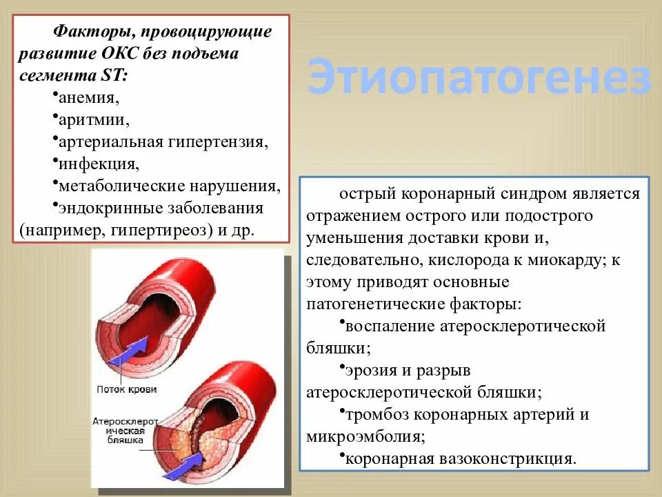 Острая коронарная недостаточность смерть причины. Острый коронарный синдром без подъема St. Острый коронарный синдром (Окс). Острый коронарный синдром осмотр. Окс неотложная помощь.