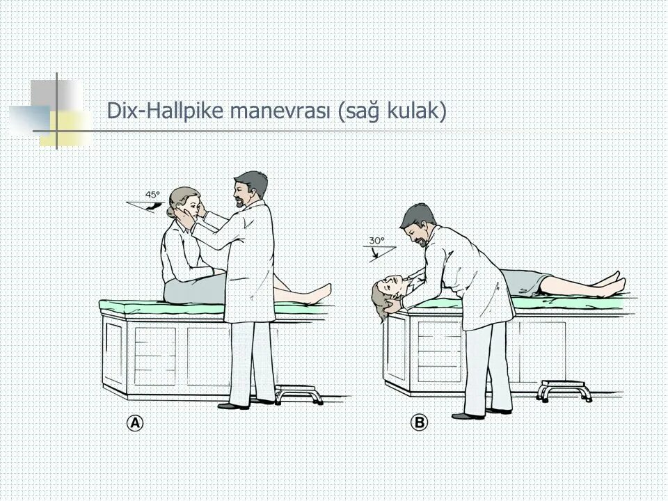 Проба холпайка. Тест Дикса-Холлпайка. Тест Хальмаги. Дикса-Холлпайка.