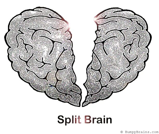 Split-Brain (Computing).