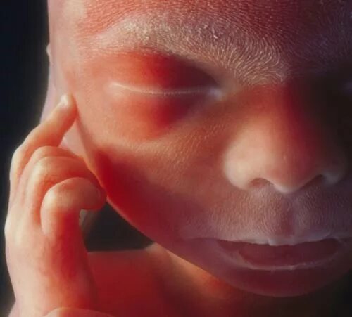Как выглядит ребенок в 19 недель A child is born, Photo book, Iconic photos