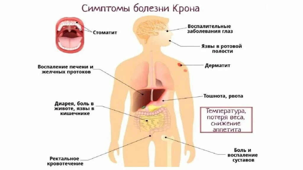 Может ли болеть кишечник. Болит желудок и кишечник. Болит живот и температура. Болит желудок и подняла ь температура.