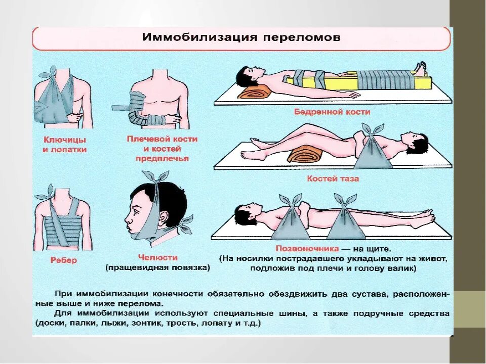 Оказание первой помощи при травмах опорно-двигательной системы. Первая помощь при травмах опорно двигательного аппарата. Первая помощь при травмах и ранениях опорно двигательного аппарата. Первая помощь при повреждении опорно-двигательной системы. Обж 8 класс первая помощь при травмах