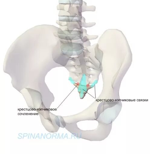 Сильно болит крестец. Крестцово копчиковый гемиартроз. Крестцово копчиковый гемартроз. Перелом крестцово копчикового сочленения. Крестцовокопчековый гемартроз.
