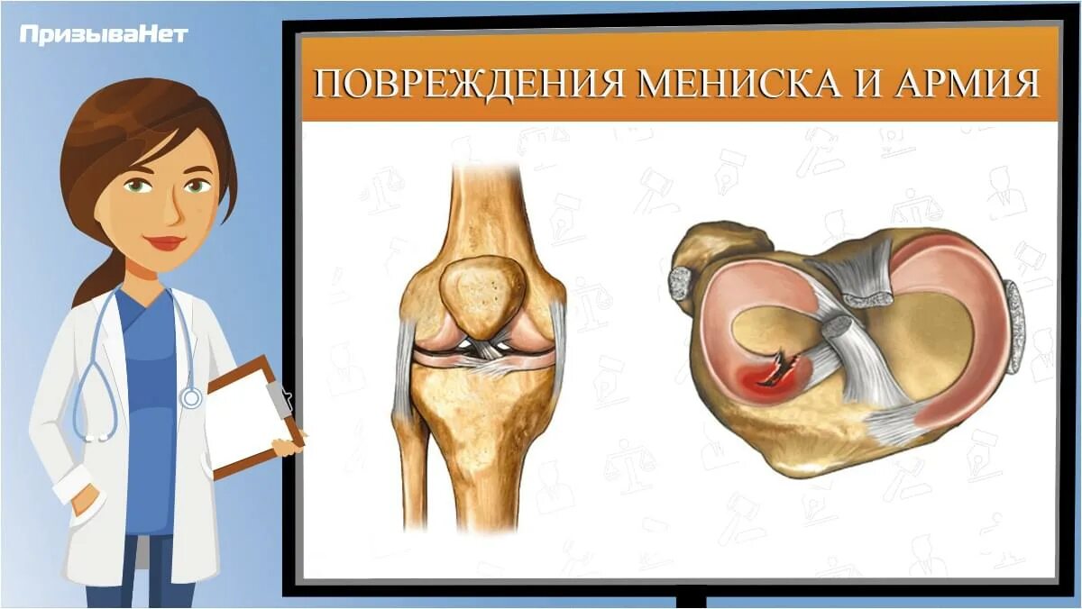 Берут ли в армию с разрывом мениска.