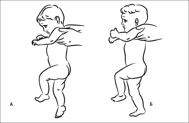 Рефлекс автоматической походки у новорожденных. Рефлекс автоматической ходьбы у новорожденных. Рефлекс опоры у грудничка. Шаговый рефлекс у новорожденных.
