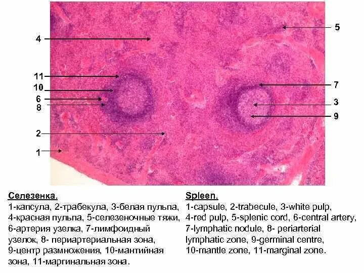 Селезенка гистология препарат. Селезенка микропрепарат гистология. Селезенка кошки препарат гистология. Препарат селезёнка окраска гематоксилин-эозин. В селезенке образуются клетки