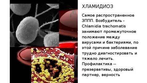 Хламидиоз причины