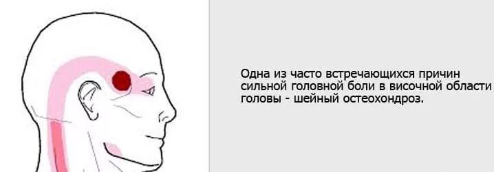 Болит голова. Боль в височной области головы. Болит голова вэ. Головная боль локализация. Ноющая боль в висках