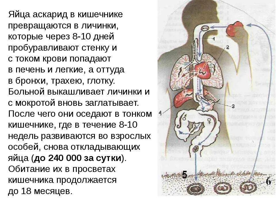 Частый аскаридоз