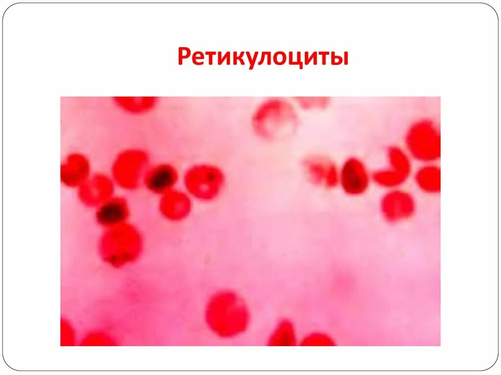 Высокофлуоресцирующие ретикулоциты. Ретикулоциты суправитальная окраска. ретикулоциты микроскопия.