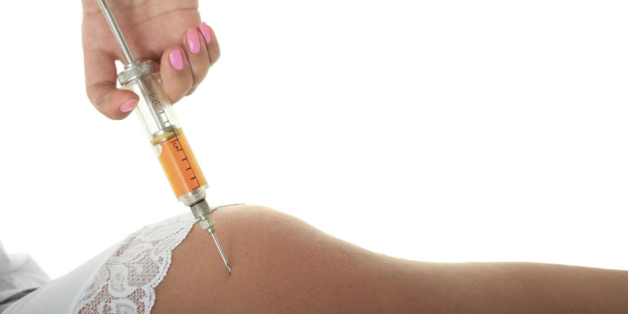 Алгоритм выполнения внутрикожной инъекции алгоритм. Правильно поставить укол внутримышечно. Место введения укола в ягодицу. Внутрикожная инъекция проба манту. После введения внутримышечного укола в ягодицу.