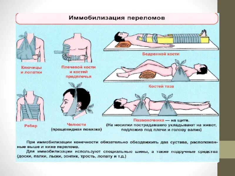 Какова первая помощь при травме. Оказание первой помощи при травмах опорно-двигательной системы. Первая помощь при травмах опорно двигательного аппарата. Первая помощь при травмах и ранениях опорно двигательного аппарата. Первая помощь при повреждении опорно-двигательной системы.