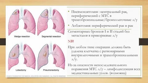 Пульмонэктомия