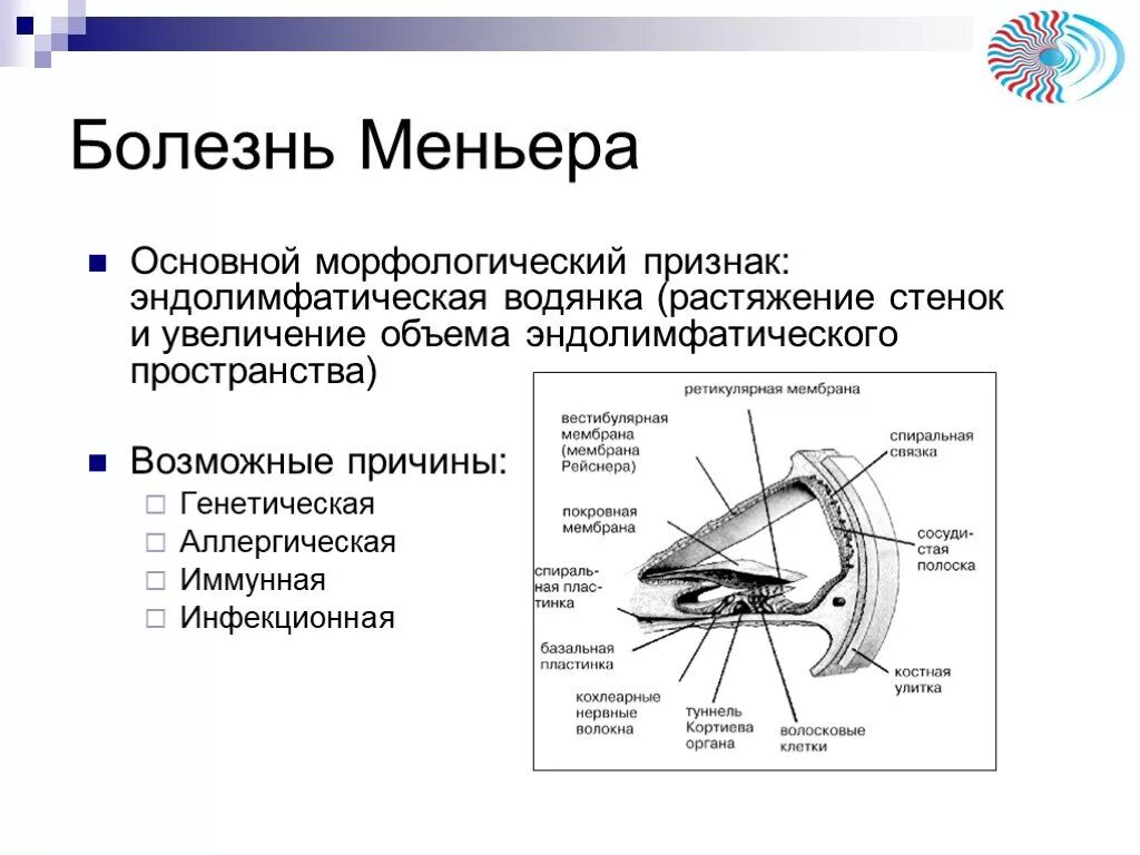 Признаки болезни меньера и лечение у женщин. Ведущими признаками болезни Меньера являются. Болезнь Меньера. Синдром Меньера. Болезнь Меньера симптомы.