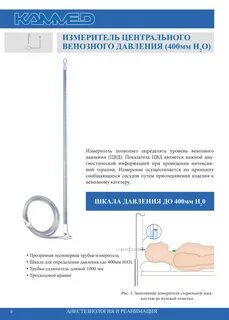 Укажите метод измерения венозного давления