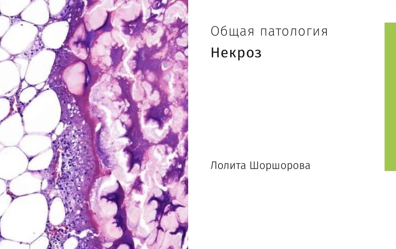 Как выглядит некроз тканей фото Gangrene of the foot Mayo Clinic