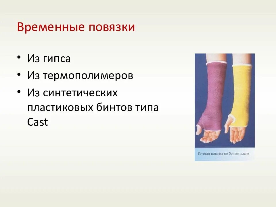 Материал для временной повязки. Виды гипсовых повязок. десмургия презентация. по характеру и цели иммобилизации повязки бывают.