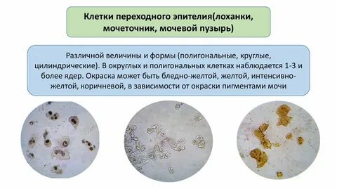 Эпителий в моче фото