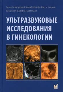 Ультразвуковая диагностика в гинекологии