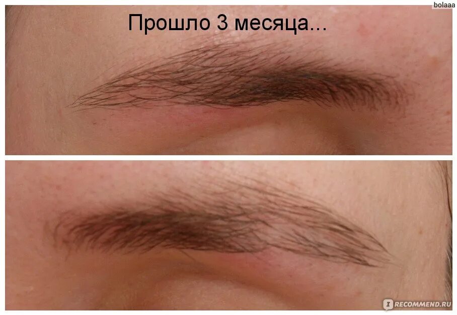 Этапы отращивания бровей. Отрастить брови. Этапы отращивания бровей. Отросшие брови после выщипывания. За какое время отрастают брови.