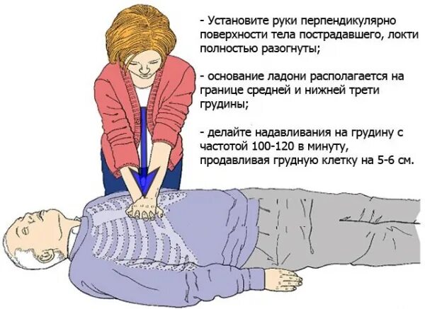 Давление на грудину пострадавшего