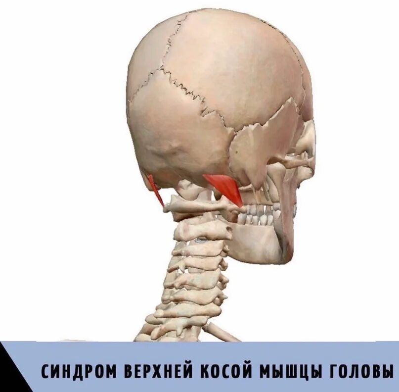 Задние кости черепа. Выйная линия черепа. Верхняя выйная линия затылочной. Верхней выйной линии и сосцевидному отростку.