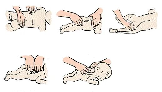 Массаж при дисплазии тазобедренных суставов у грудничков. Массаж при дисплазии тазобедренных. Массаж при дисплазии тазобедренных суставов у детей 1 года. Массаж при дисплазии тазобедренных суставов у детей 1 года. Массаж при дисплазии у грудничков 3 месяца.