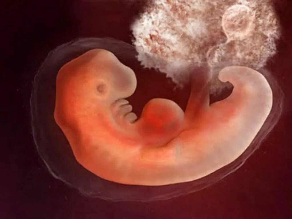 Ребенок в первые месяцы беременности. Плод 3-4 недели беременности. Эмбрион на 5 неделе беременности. Эмбрион выглядит 4 недели. Как выглядит эмбрион в 4 недели.