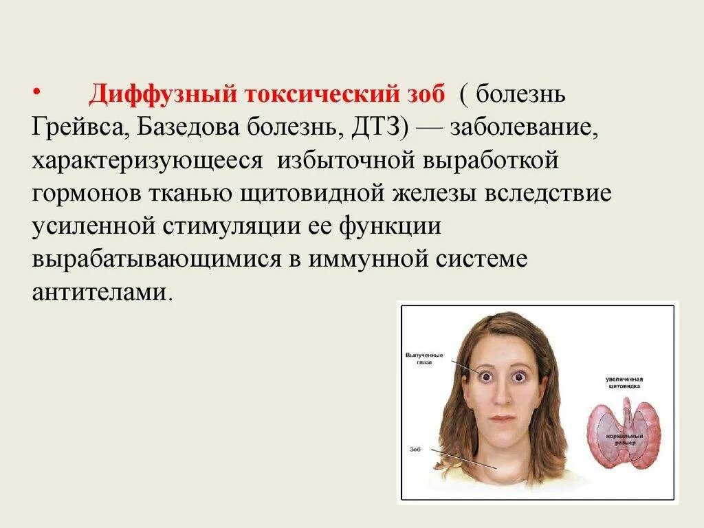 Слово гипертиреоз