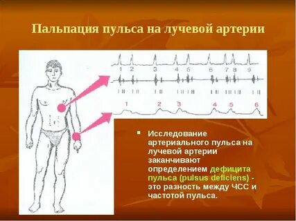 Пульс исследуют на артерии