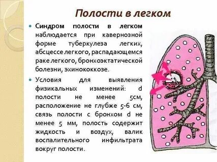 Образование полостей