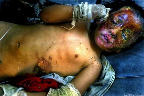 Dinarians, what about my life and damage now? 