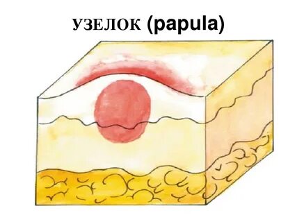 Бугорок вода
