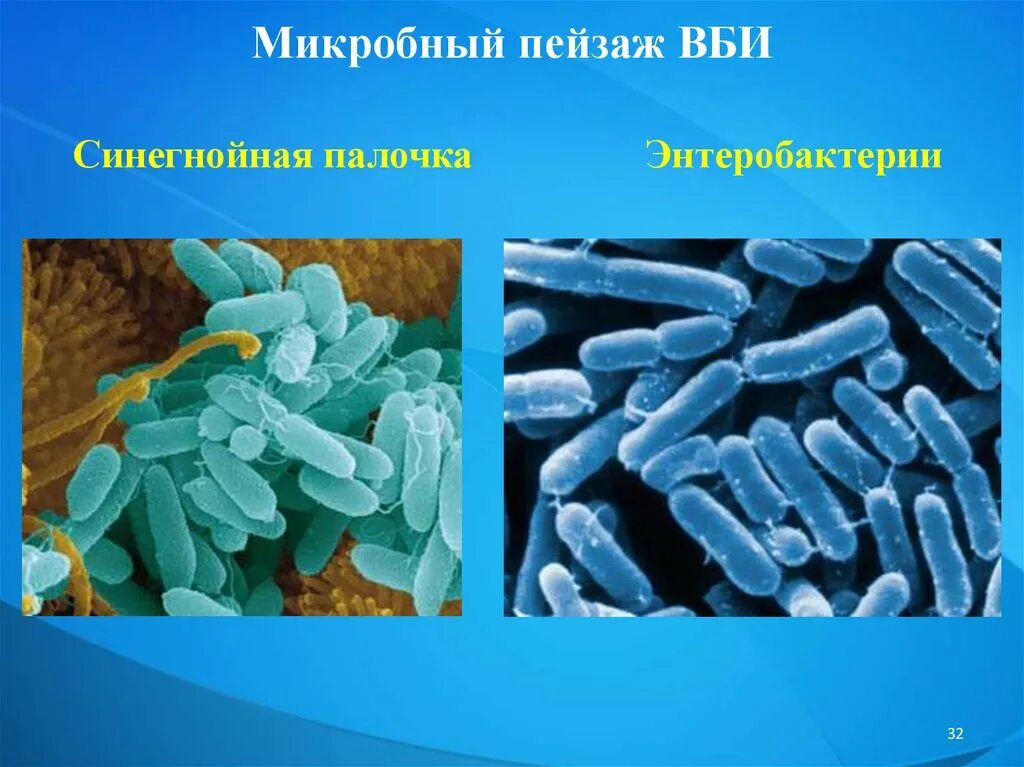 Внутрибольничные инфекции микробиология