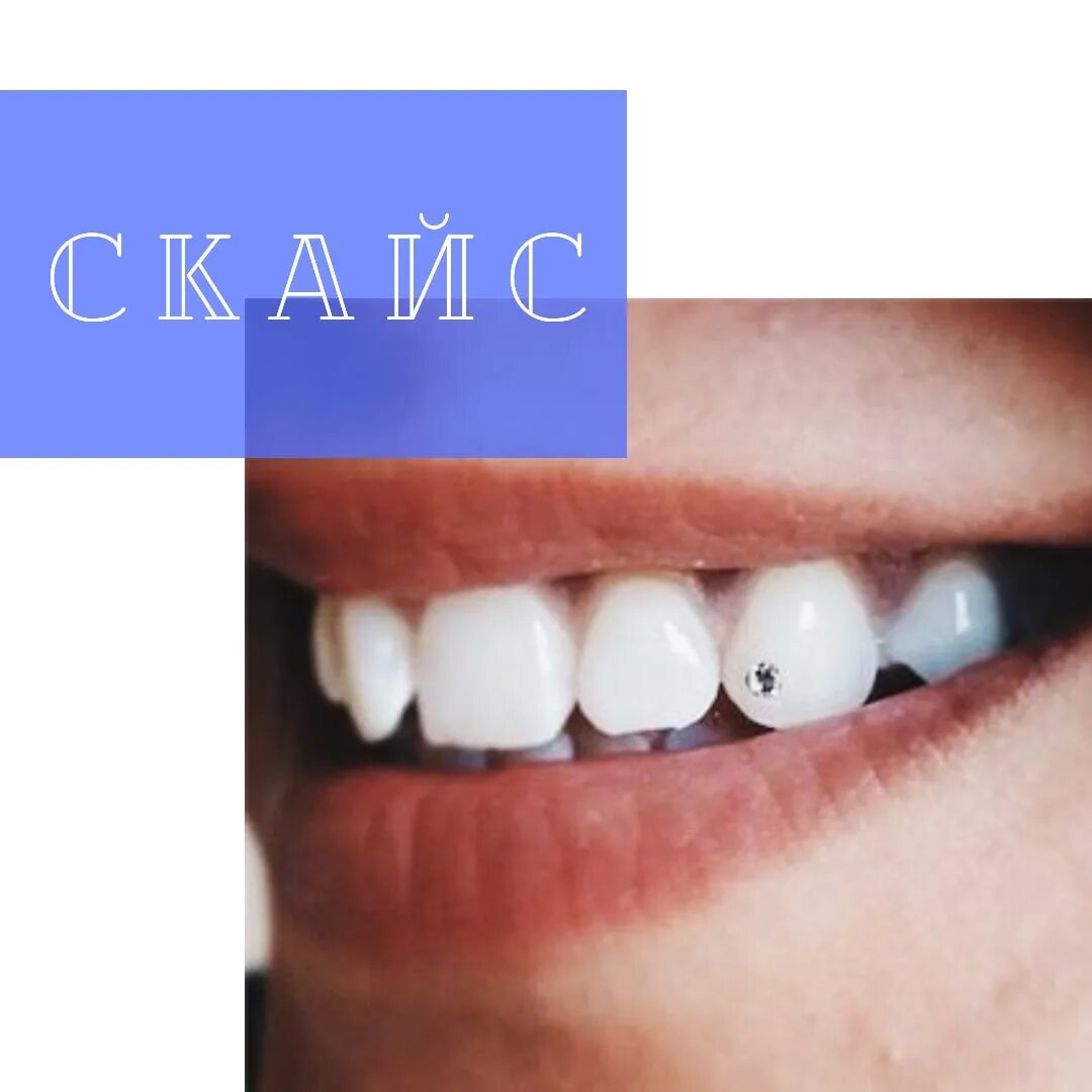 Скайс стоматология благовещенск. Скайс кемерово. Скайс кемерово. Сертификат скайсы на зубы. Скайс кемерово.