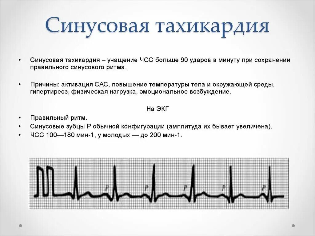 Резко сильное сердцебиение