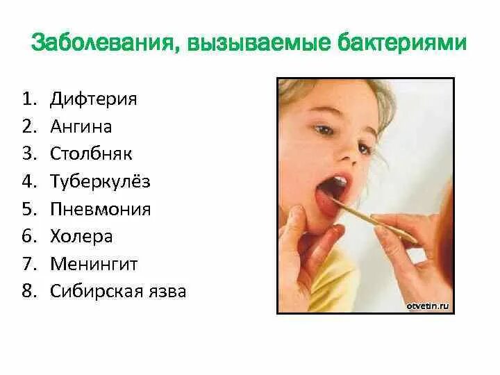 Тонзиллит вызывают бактерии. Тонзиллит вызывают бактерии