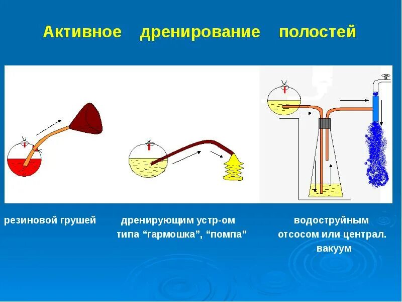 Что значит дренировать