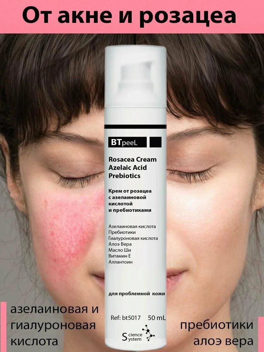 косметика урьяж для розацеа. косметика розацеа отзывы. лечебная косметика биодерма для проблемной кожи. косметика розацеа отзывы. La roche posay от купероза.