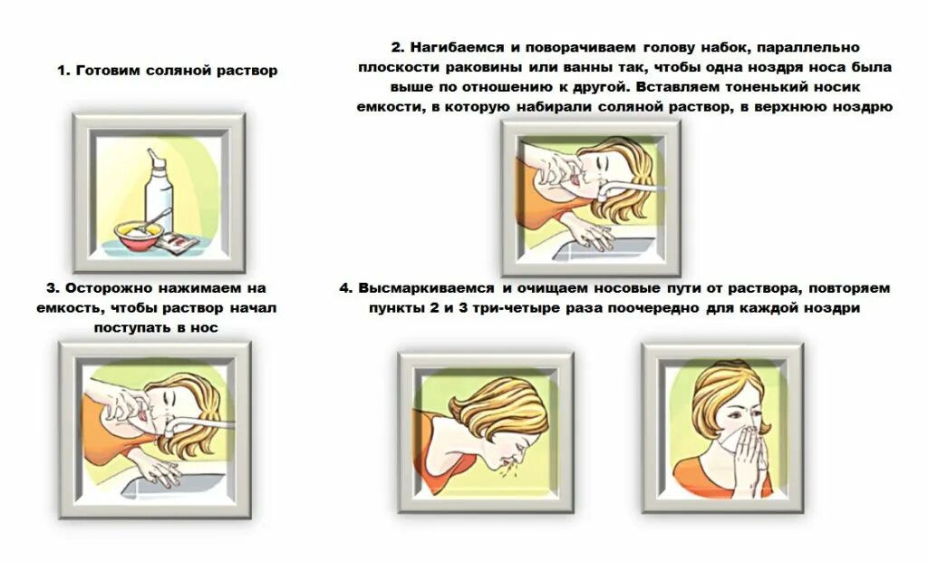 Как промывать нос солевым раствором при гайморите. Промывание полости носа памятка. промывание ушей алгоритм действий. алгоритм промывания носа в стационаре. болит ухо после промывания носа.