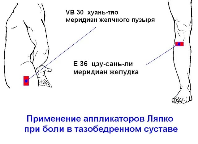 Меридиан желчного пузыря точки. Хуань тяо точка. Меридиан желчного пузыря точки на бедре. Тяо тяо тяо. Ла тяо