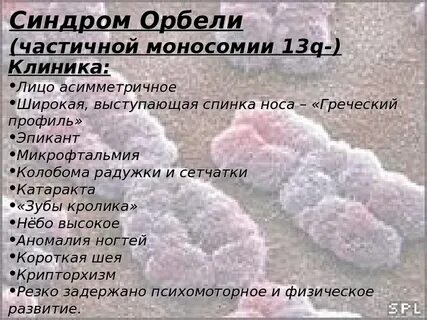 Феномен орбели гинецинского