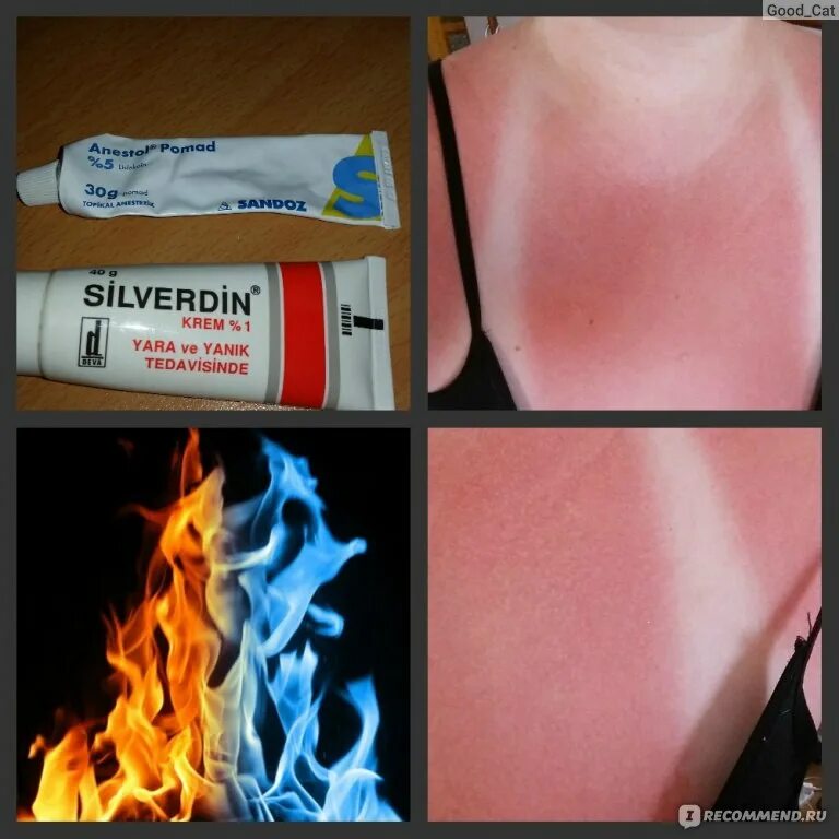 Кожная реакция на солнце. Аллергия на синтетику на коже. Крем от солнечной аллергии на коже. Мазь от аллергии от солнца. Аллергия на солнце какие таблетки помогут