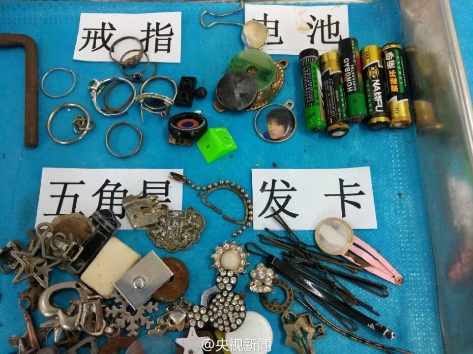 Какие предметы достают из. Предметы проглоченные детьми. вещи которые проглатывают дети. предметы которые глотают дети. коллекция предметов, проглоченных детьми.