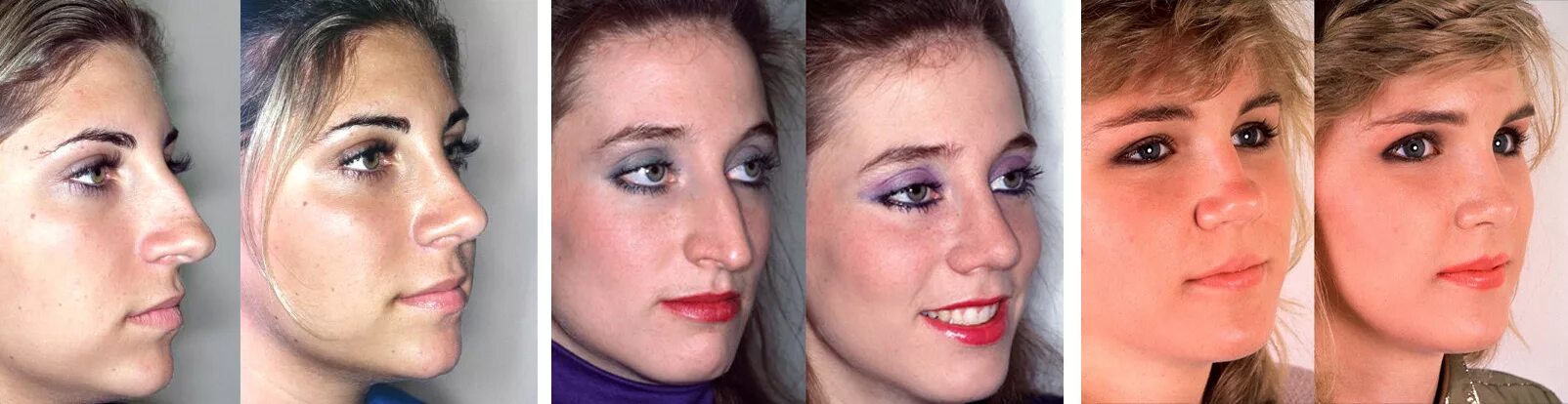 Pin by Elizabeth Sanchez on DIY Christmas gifts Nose plastic surgery, Plastic su