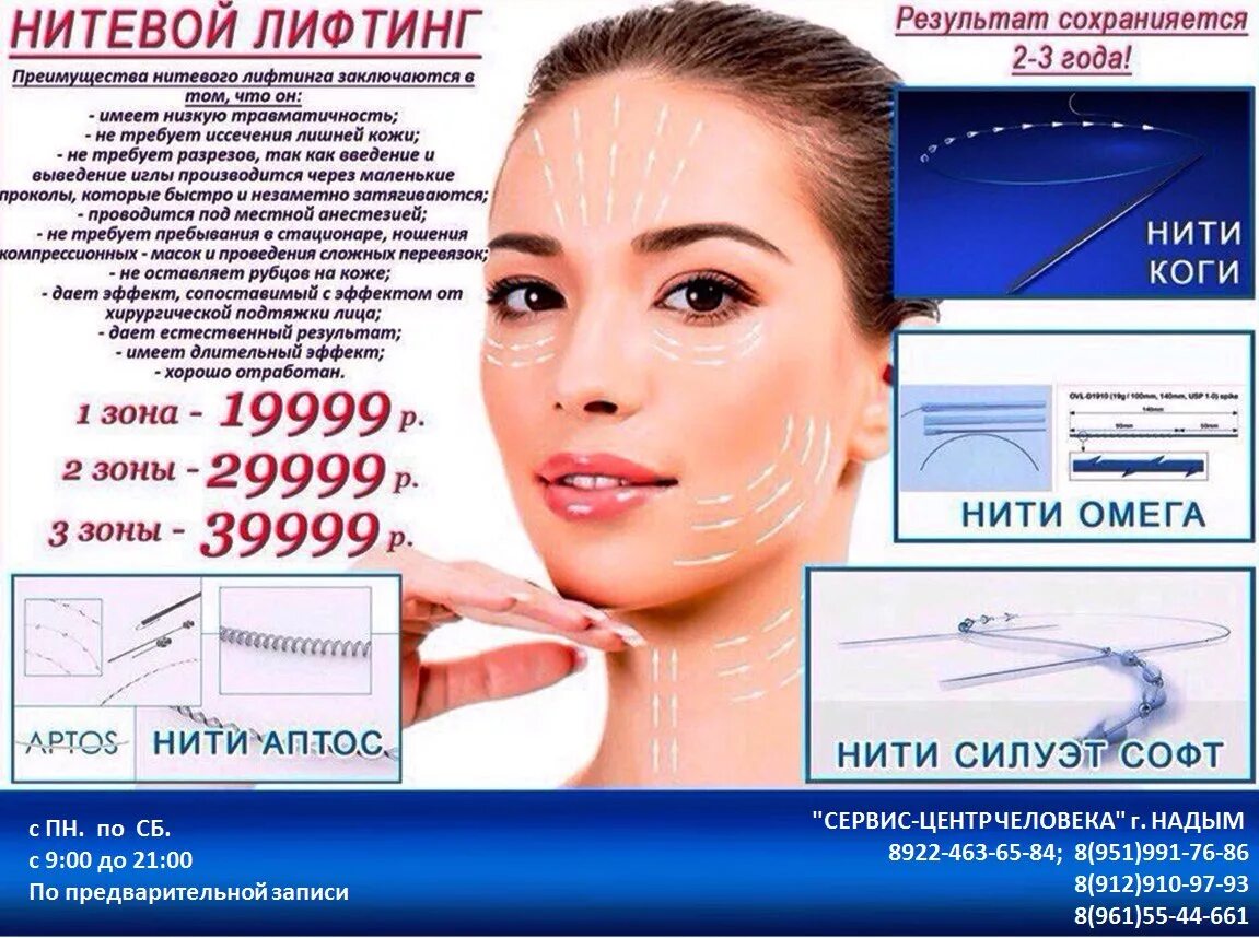 Нитевой лифтинг Aptos. Нити Коги для подтяжки лица. Нити коги отзывы форум